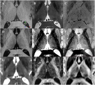 DiMANI: diffusion MRI for anatomical nuclei imaging—Application for the direct visualization of thalamic subnuclei